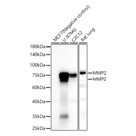 Western Blot - Anti-MMP2 Antibody [ARC57602] (A329611) - Antibodies.com