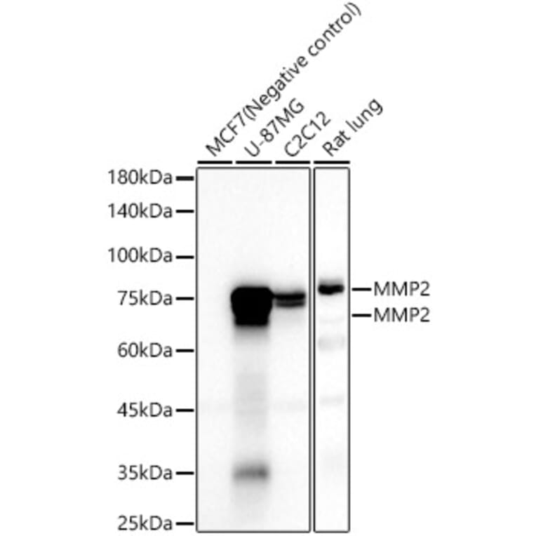 Western Blot - Anti-MMP2 Antibody [ARC57602] (A329611) - Antibodies.com