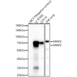 Western Blot - Anti-MMP2 Antibody [ARC57602] (A329611) - Antibodies.com