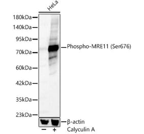 Western Blot - Anti-Mre11 (Phospho Ser676) Antibody (A329621) - Antibodies.com