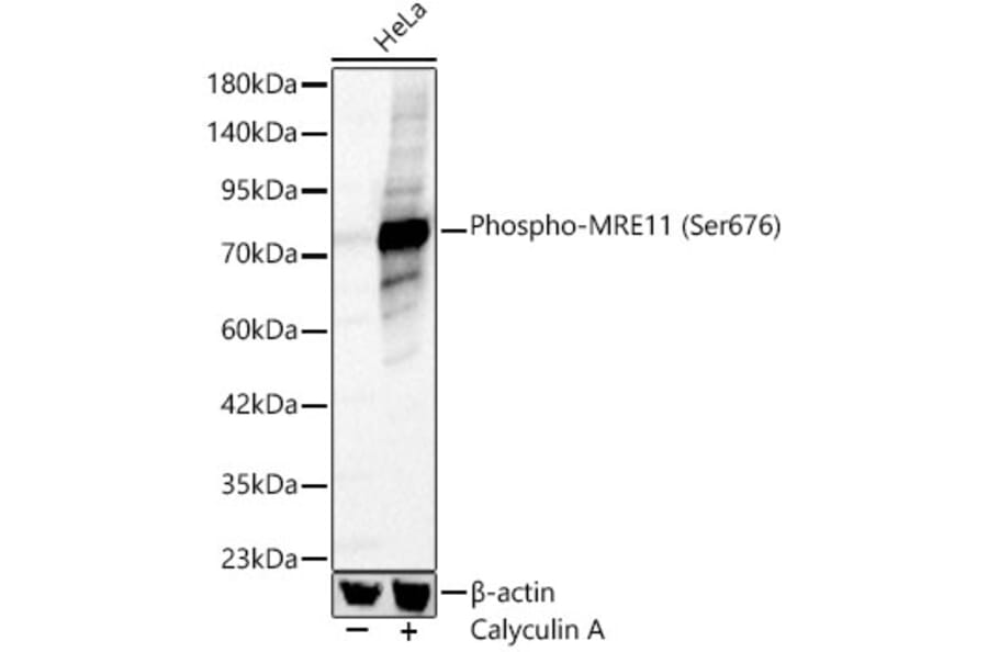 Western Blot - Anti-Mre11 (Phospho Ser676) Antibody (A329621) - Antibodies.com