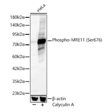 Western Blot - Anti-Mre11 (Phospho Ser676) Antibody (A329621) - Antibodies.com