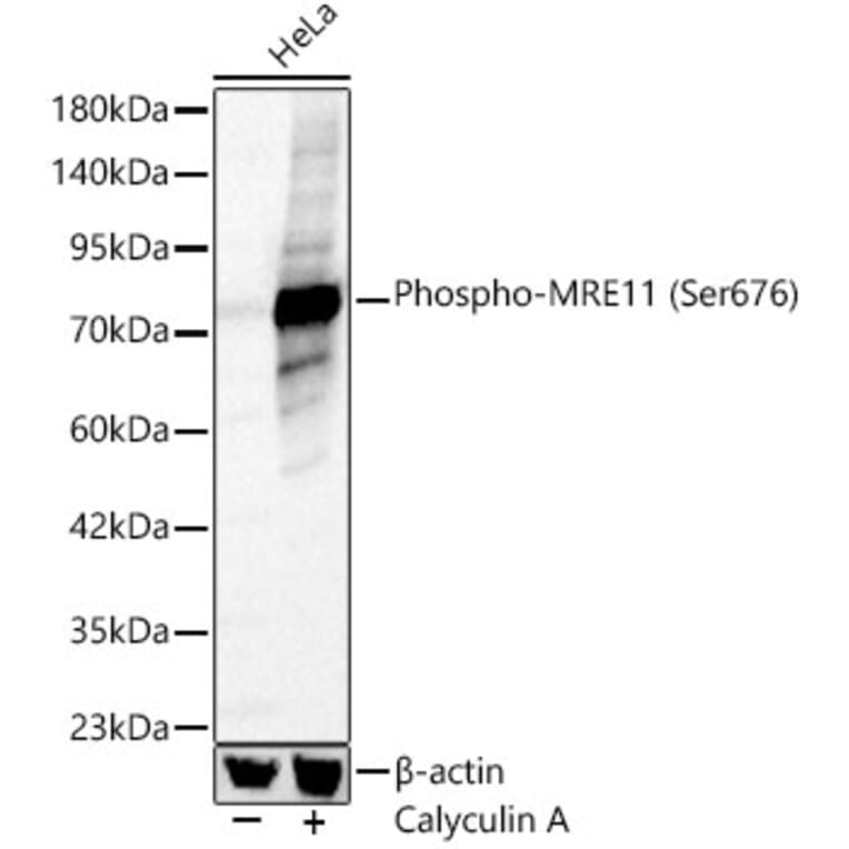 Western Blot - Anti-Mre11 (Phospho Ser676) Antibody (A329621) - Antibodies.com