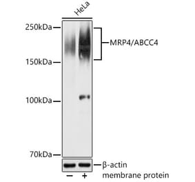 Western Blot - Anti-MRP4 Antibody (A329623) - Antibodies.com