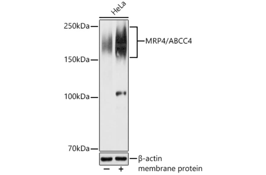 Western Blot - Anti-MRP4 Antibody (A329623) - Antibodies.com