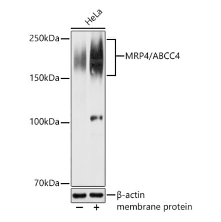 Western Blot - Anti-MRP4 Antibody (A329623) - Antibodies.com
