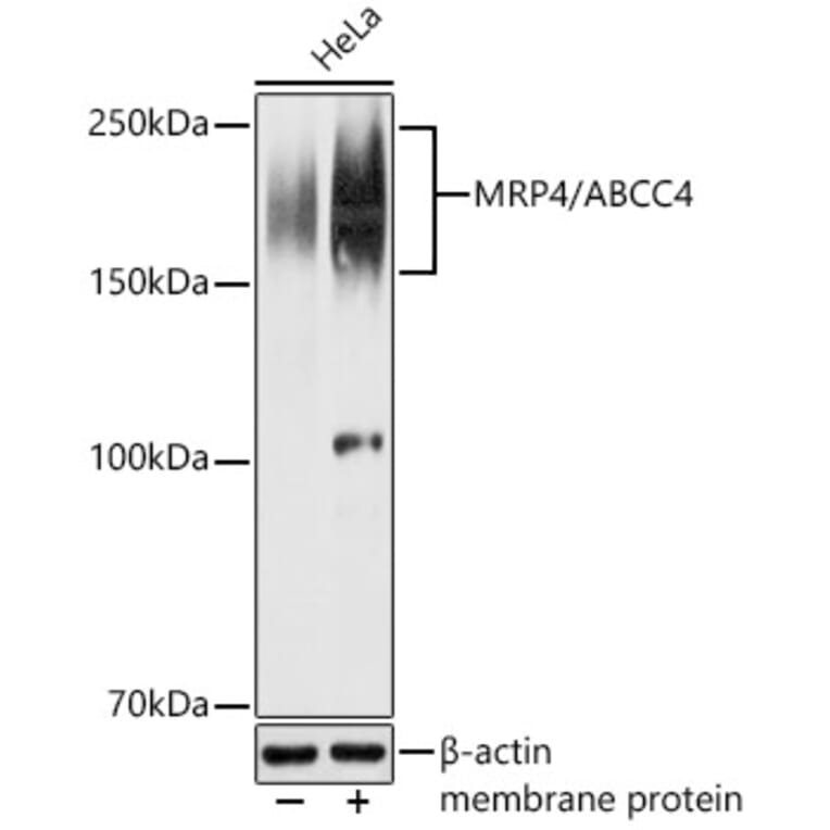 Western Blot - Anti-MRP4 Antibody (A329623) - Antibodies.com