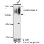 Western Blot - Anti-MRP4 Antibody (A329623) - Antibodies.com