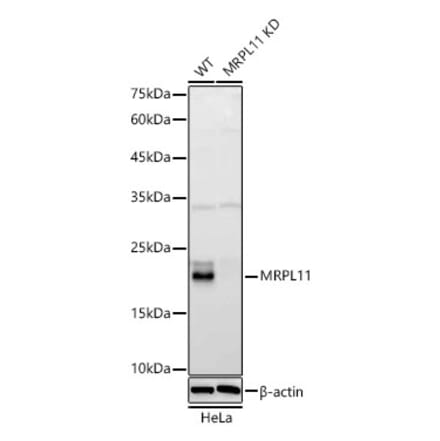 Western Blot - Anti-MRPL11 Antibody (A329625) - Antibodies.com