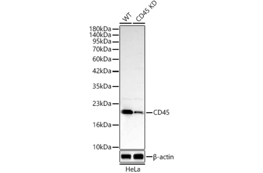 Western Blot - Anti-MRPL13 Antibody (A329626) - Antibodies.com