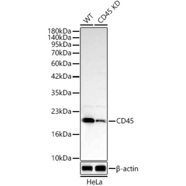 Western Blot - Anti-MRPL13 Antibody (A329626) - Antibodies.com