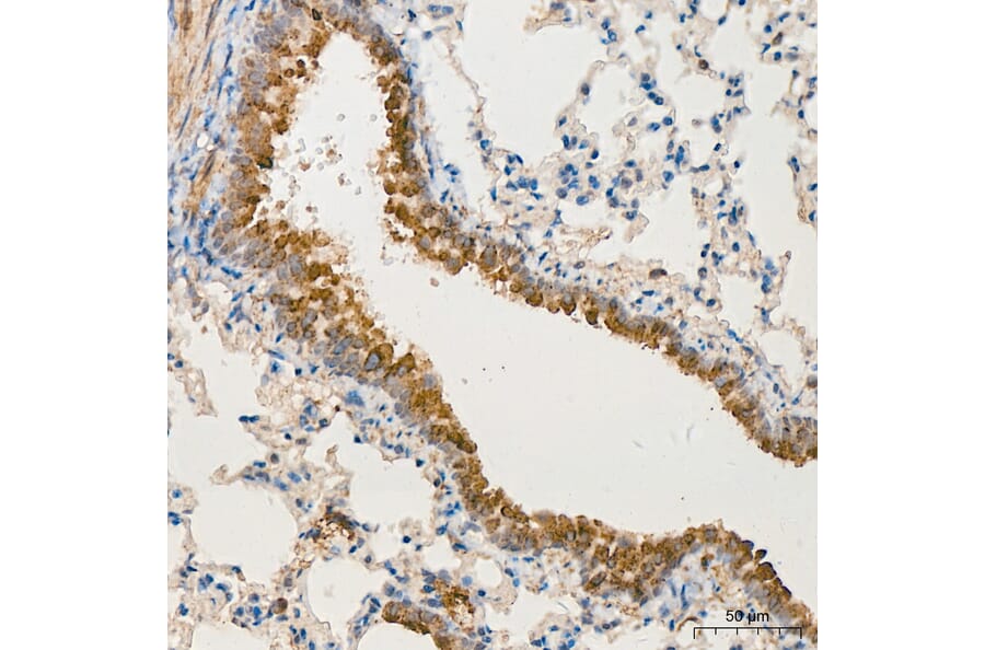 Immunohistochemistry - Anti-MRPL13 Antibody (A329626) - Antibodies.com