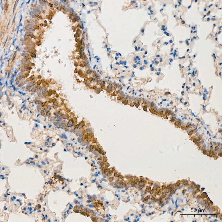 Immunohistochemistry - Anti-MRPL13 Antibody (A329626) - Antibodies.com