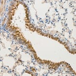 Immunohistochemistry - Anti-MRPL13 Antibody (A329626) - Antibodies.com