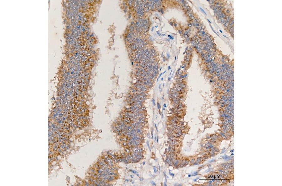 Immunohistochemistry - Anti-MRPL13 Antibody (A329626) - Antibodies.com