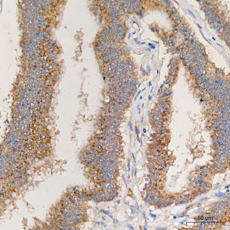 Immunohistochemistry - Anti-MRPL13 Antibody (A329626) - Antibodies.com