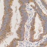 Immunohistochemistry - Anti-MRPL13 Antibody (A329626) - Antibodies.com