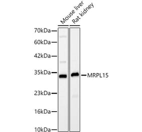 Western Blot - Anti-MRPL15 Antibody (A329627) - Antibodies.com