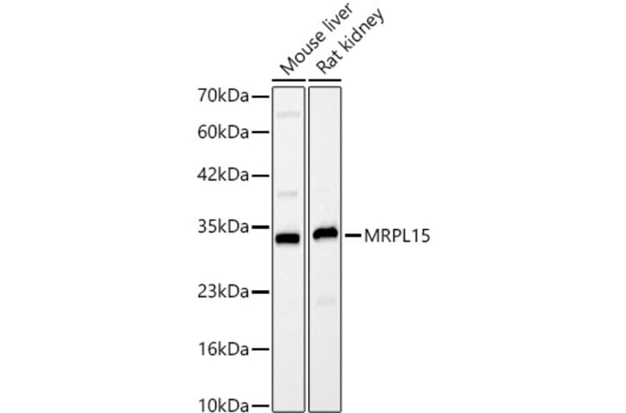 Western Blot - Anti-MRPL15 Antibody (A329627) - Antibodies.com