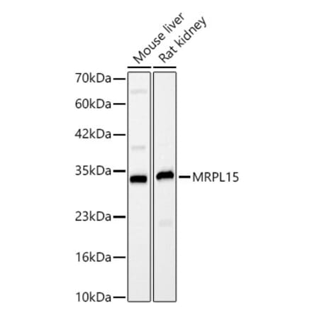 Western Blot - Anti-MRPL15 Antibody (A329627) - Antibodies.com