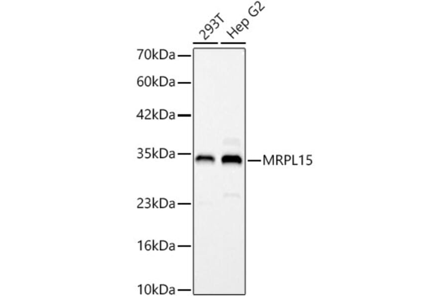 Western Blot - Anti-MRPL15 Antibody (A329627) - Antibodies.com