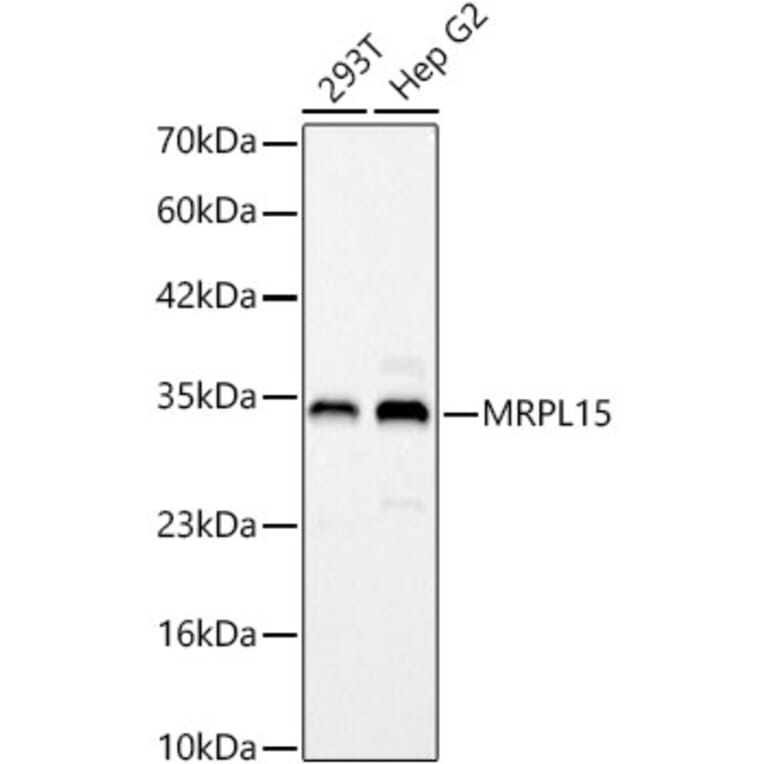 Western Blot - Anti-MRPL15 Antibody (A329627) - Antibodies.com