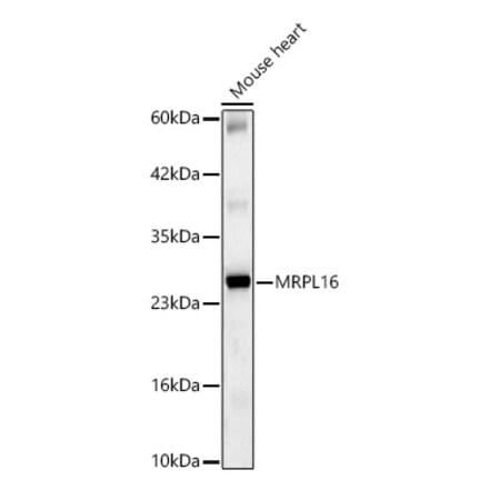 Western Blot - Anti-MRPL16 Antibody (A329628) - Antibodies.com