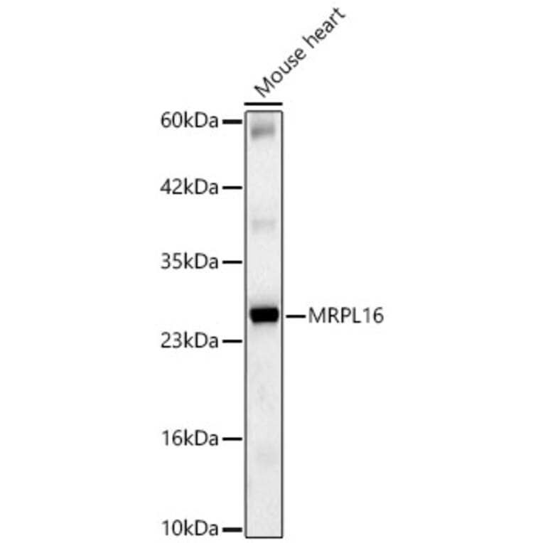 Western Blot - Anti-MRPL16 Antibody (A329628) - Antibodies.com