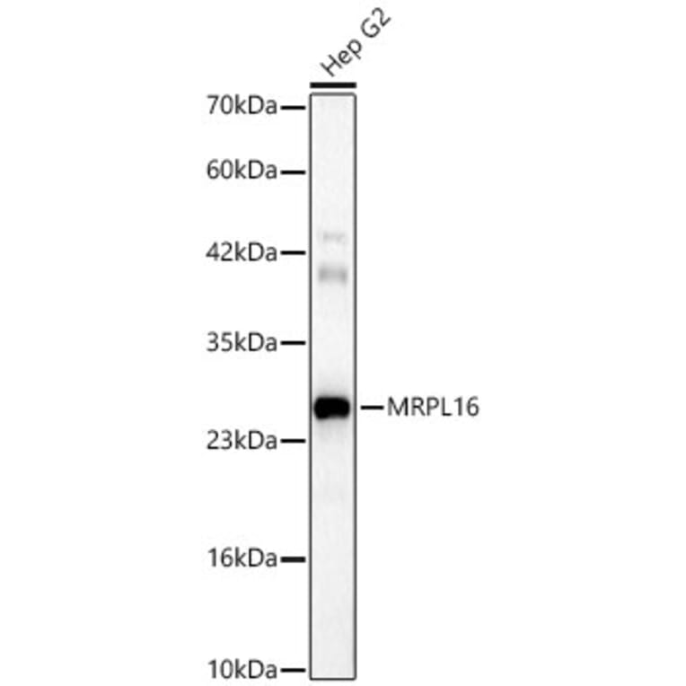 Western Blot - Anti-MRPL16 Antibody (A329628) - Antibodies.com