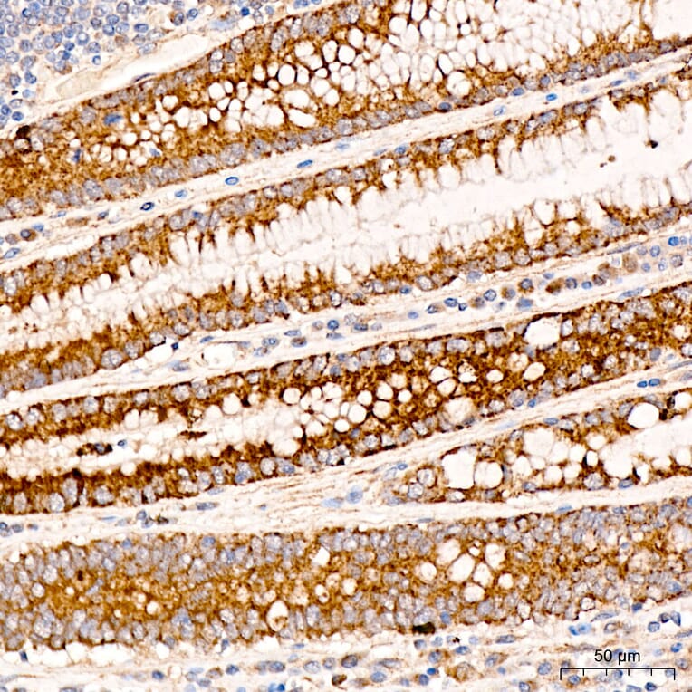 Immunohistochemistry - Anti-MRPL19 Antibody (A329629) - Antibodies.com