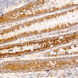 Immunohistochemistry - Anti-MRPL19 Antibody (A329629) - Antibodies.com