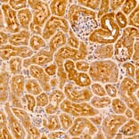 Immunohistochemistry - Anti-MRPL19 Antibody (A329629) - Antibodies.com