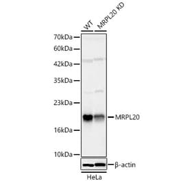 Western Blot - Anti-MRPL20 Antibody (A329630) - Antibodies.com