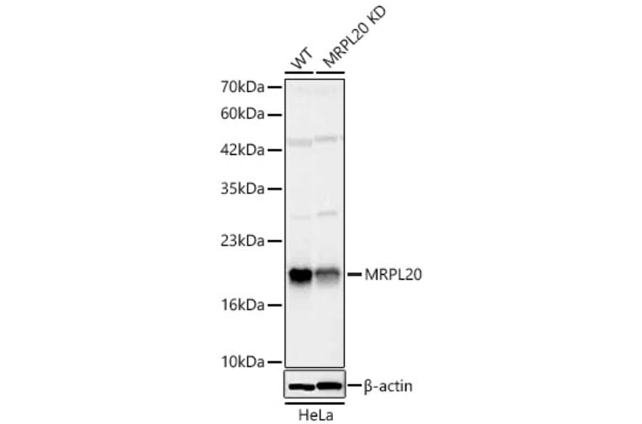 Western Blot - Anti-MRPL20 Antibody (A329630) - Antibodies.com