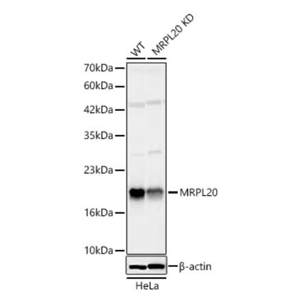 Western Blot - Anti-MRPL20 Antibody (A329630) - Antibodies.com