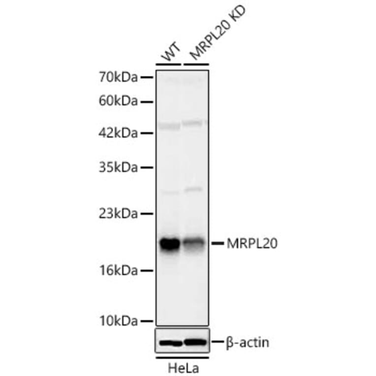 Western Blot - Anti-MRPL20 Antibody (A329630) - Antibodies.com