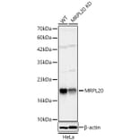 Western Blot - Anti-MRPL20 Antibody (A329630) - Antibodies.com
