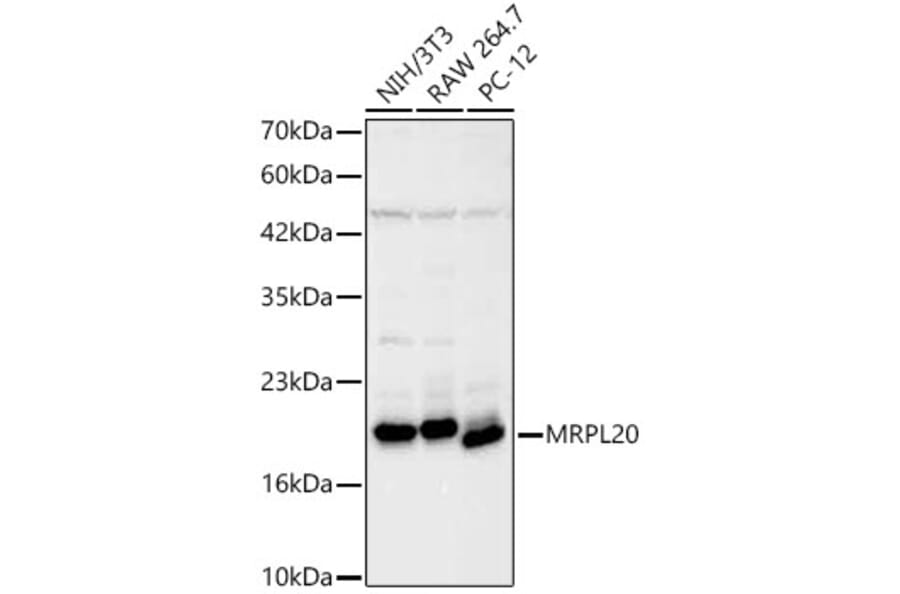 Western Blot - Anti-MRPL20 Antibody (A329630) - Antibodies.com