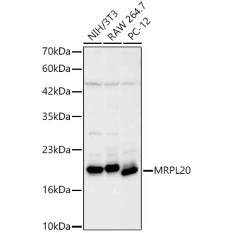 Western Blot - Anti-MRPL20 Antibody (A329630) - Antibodies.com