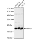 Western Blot - Anti-MRPL20 Antibody (A329630) - Antibodies.com