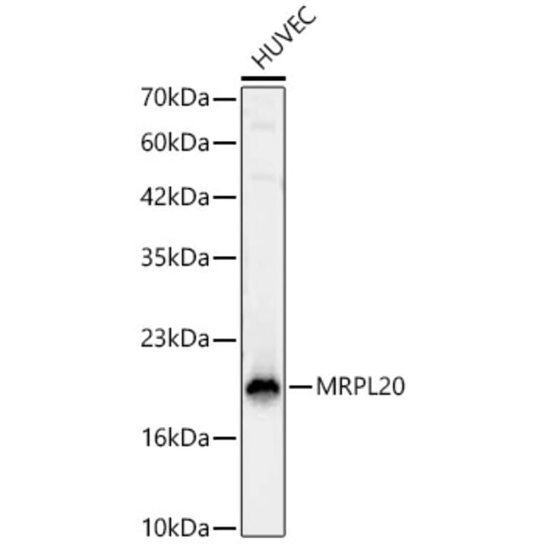 Western Blot - Anti-MRPL20 Antibody (A329630) - Antibodies.com