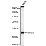 Western Blot - Anti-MRPL20 Antibody (A329630) - Antibodies.com
