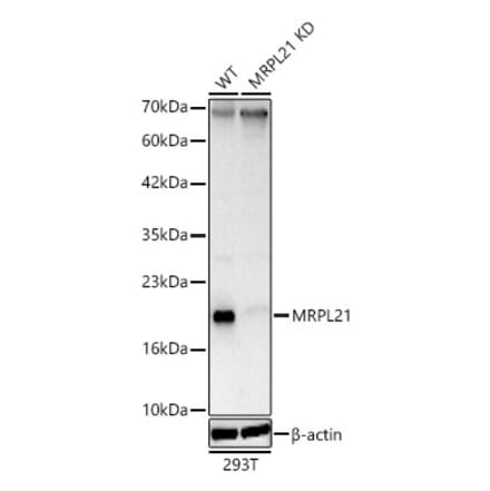 Western Blot - Anti-MRPL21 Antibody (A329631) - Antibodies.com