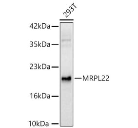 Western Blot - Anti-MRPL22 Antibody (A329632) - Antibodies.com