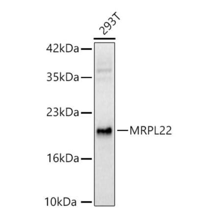 Western Blot - Anti-MRPL22 Antibody (A329632) - Antibodies.com