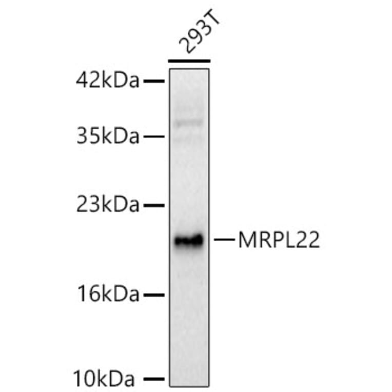 Western Blot - Anti-MRPL22 Antibody (A329632) - Antibodies.com