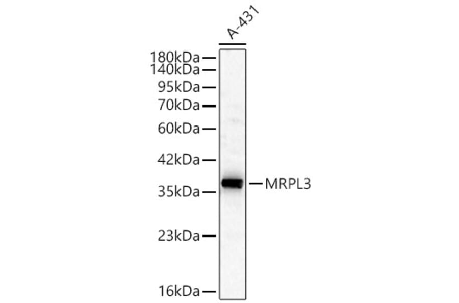 Western Blot - Anti-MRPL3 Antibody (A329634) - Antibodies.com