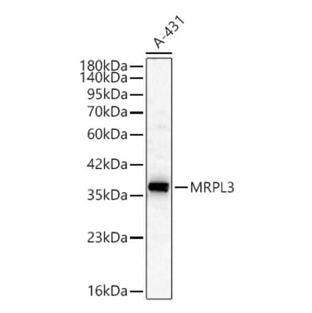 Western Blot - Anti-MRPL3 Antibody (A329634) - Antibodies.com