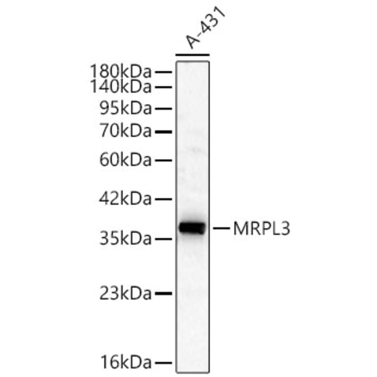 Western Blot - Anti-MRPL3 Antibody (A329634) - Antibodies.com