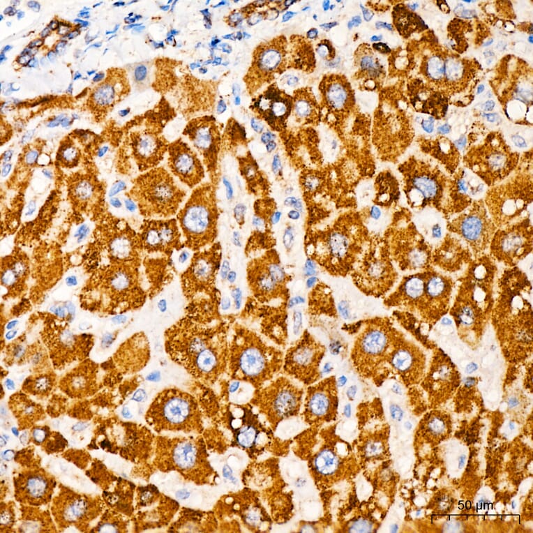 Immunohistochemistry - Anti-MRPL33 Antibody (A329635) - Antibodies.com